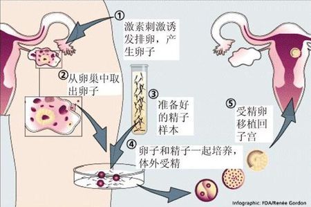 一般不妊検査・タイミング療法